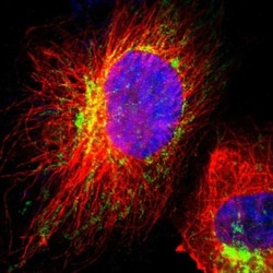 HCCS Antibody, Novus Biologicals 25 &mu;L; Unlabeled:Antibodies, Polyclonal
